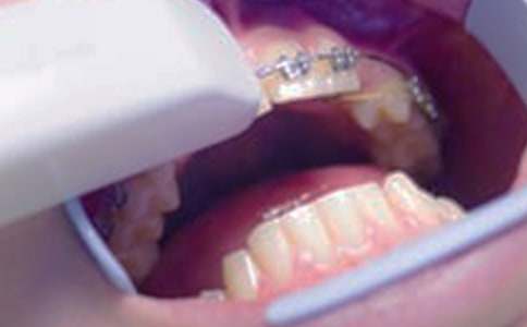 孕妇牙龈肿痛应该怎么办