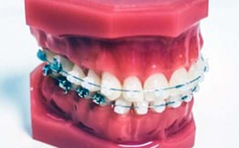 治疗牙龈出血的5款食疗
