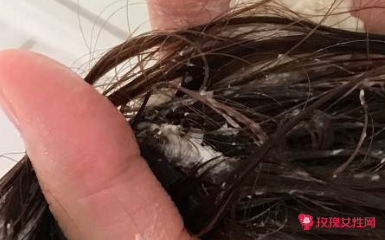 护发素过期了还能用吗